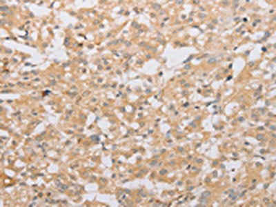 ATG9A Antibody