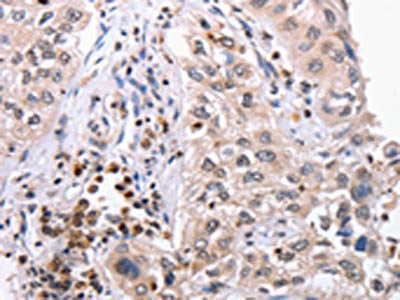 EPCAM Antibody