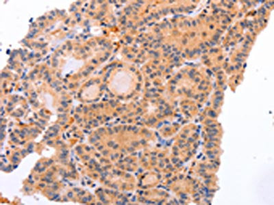 NR3C1 Antibody