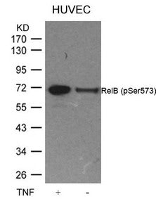 Phospho-RELB (Ser573) Antibody