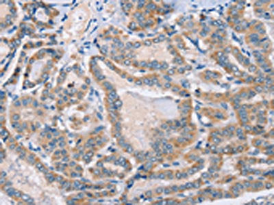 PHYH Antibody
