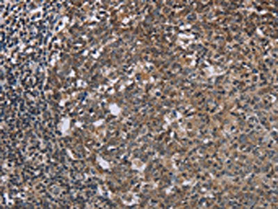TBX5 Antibody