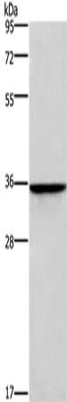HOXB2 Antibody