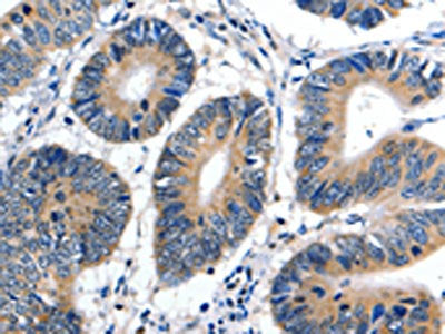 CDKN1B Antibody