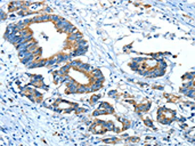 GLRA1 Antibody