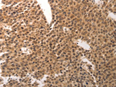 CDC6 Antibody