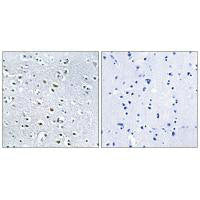 NPHP4 Antibody