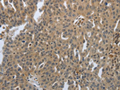 PTPRT Antibody