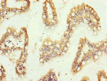 TRIM10 Antibody