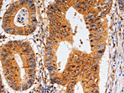CDK6 Antibody