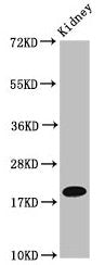 NAA38 Antibody