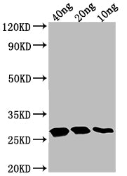 TTYH2 Antibody