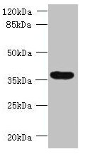 TRIM51 Antibody