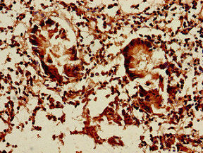 DCTN5 Antibody