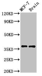 MENT Antibody