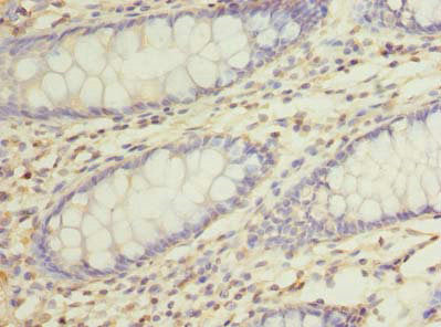 RUSC1 Antibody