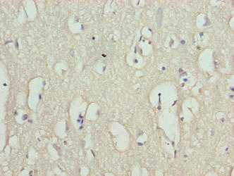 RHPN1-AS1 Antibody