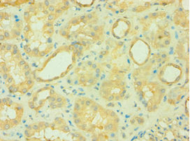 CARD10 Antibody