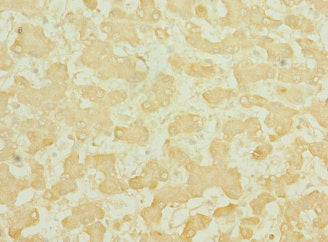 TEKT3 Antibody