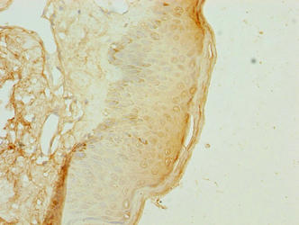 KRTAP3-2 Antibody