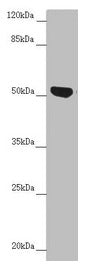 NUF2 Antibody