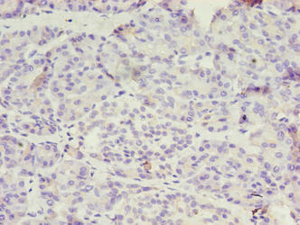 DPH1 Antibody