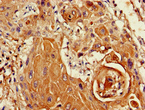 SETD5 Antibody