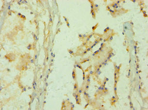 GLO1 Antibody