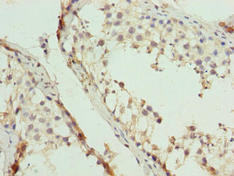 EIF5A2 Antibody