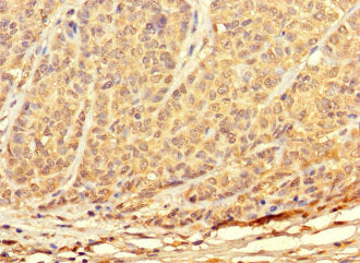 TKTL2 Antibody