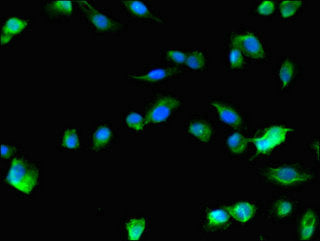 RAB1B Antibody
