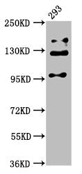 RAB3GAP2 Antibody
