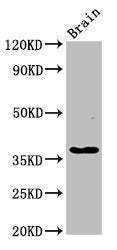 GHITM Antibody