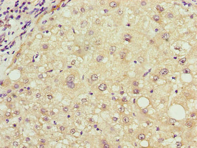 RHOJ Antibody