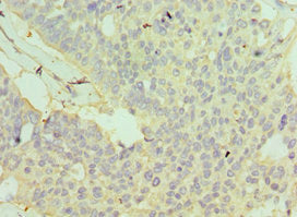 GSTO2 Antibody