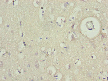 BCAS3 Antibody
