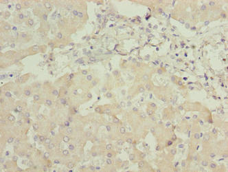 ANKRA2 Antibody