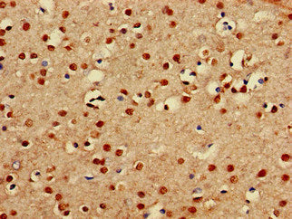 PRDM16 Antibody