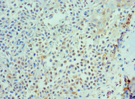 IL21 Antibody