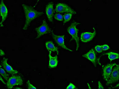 CABP2 Antibody