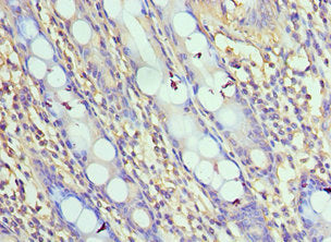 NLRC4 Antibody