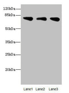 ACSS2 Antibody