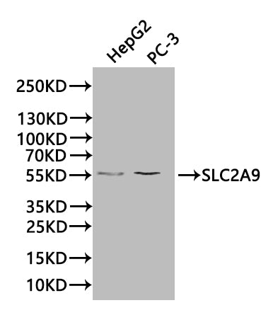 SLC2A9 Antibody