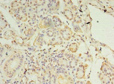 MCUB Antibody