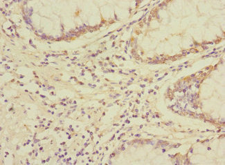 UBAP1 Antibody