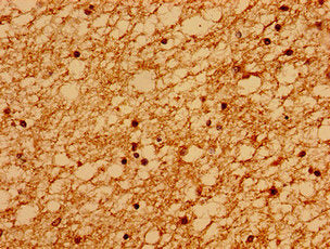 SACS Antibody
