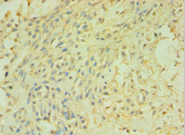 CALML5 Antibody
