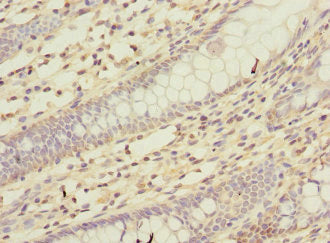 KCND2 Antibody