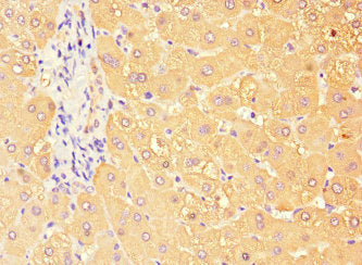 TBC1D7 Antibody