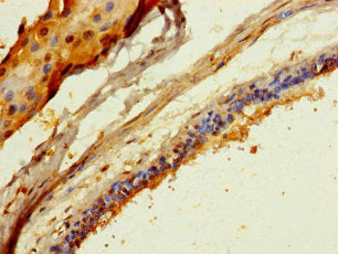 COL20A1 Antibody